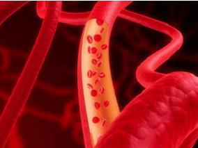 TKI治疗CML的最佳时机选择