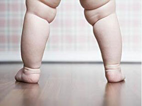 肥胖但无相关代谢异常人群的慢性肾病风险