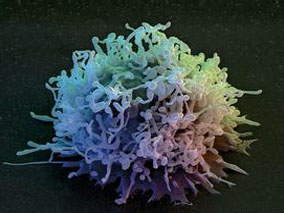 超早期复发滤泡性淋巴瘤患者异体移植优于自体移植