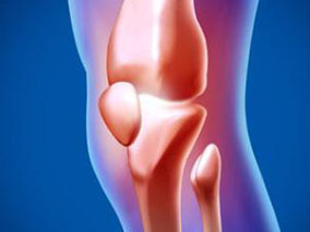 亚洲膝关节骨关节炎患者：塞来昔布vs萘普生