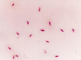 当前G-和G+菌株对磷霉素的敏感性