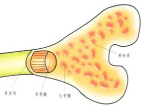 高复发风险血源性骨髓炎患者应该延长抗生素治疗持续时间