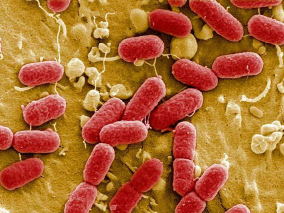 STEC患者使用抗生素是否与溶血性尿毒症综合征相关?