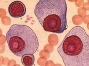 多发性骨髓瘤患者接受硼替佐米治疗有何获益？