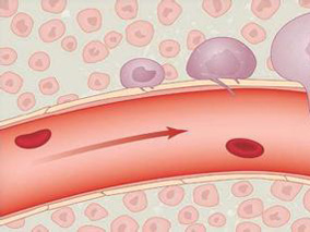 比伐卢定vs单用肝素治疗急性冠脉综合征有效性和安全性的评估方法
