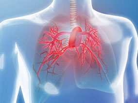 肺动脉高压初始双重口服联合治疗的疗效