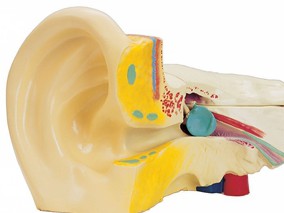 贝伐珠单抗可有效治疗神经纤维瘤2型导致的听觉损失