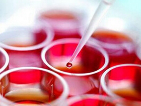 哪些他汀能降低血清尿酸水平？