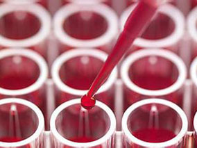 多发性骨髓瘤自体干细胞移植后单次不劣效于连续高剂量马法兰