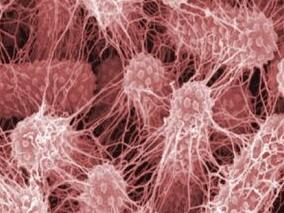 磷霉素联合美罗培南治疗产KPC-2肺炎克雷伯菌是否有效？