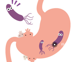 幽门螺旋杆菌一线治疗：PAM方案vs PAC方案