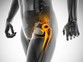 中期和长期阿仑膦酸使用者髋、转子下和股骨干骨折风险