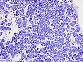 女35岁,间断性左侧腰部疼痛1周