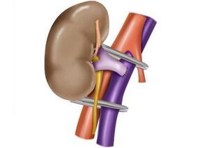 稳定肾移植患者使用阿司匹林与心血管疾病、肾衰和死亡不相关