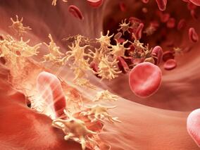 来那度胺可作为单克隆丙种球蛋白病相关难治性AVWS的新型治疗方法