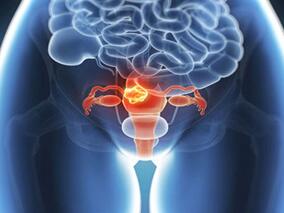 中和高风险生殖细胞瘤：TIP一线治疗更有效