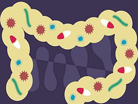 转移性结直肠癌一线治疗添加阿柏西普百害而无一利?