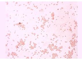 全球产超广谱β-内酰胺酶菌形势不容乐观