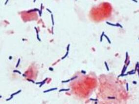 口服万古霉素能否降低CDI患者的复发风险？