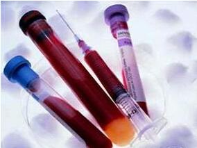 败血症和机械通气的ICU患者中米卡芬净变异性分析