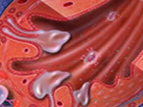 间断全身乏力7年，加重1个月，全面解析诊断治疗的“奥妙”