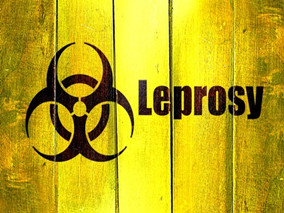 麻风病的多药治疗：消除之路的“游戏”改变者