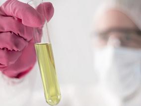 达格列净减少尿蛋白的作用具有个体差异性？