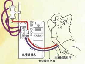 鱼油或阿司匹林能否减少透析患者的动静脉瘘失败？