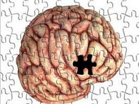 PPI是否增加肝硬化患者罹患肝性脑病的风险？