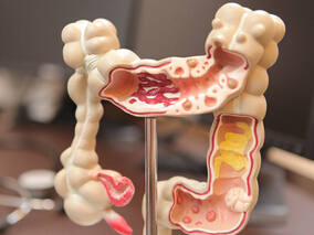 转移性结直肠癌二线全身治疗是否安全有效?