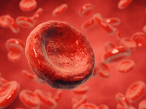 肝素诱导的血小板减少症：哪种非肝素抗凝剂更具成本效果？