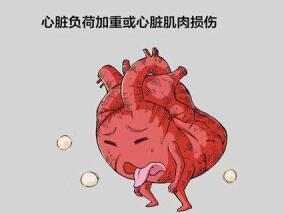 多学科讨论:不可不知!射血分数降低心衰患者的最佳治疗选择