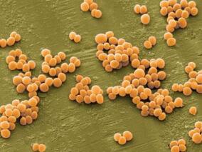 MRSA血液感染:更换抗生素患者万古霉素梯度MICs的确定或无实际意义