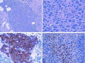 扑朔迷离刑侦案 多学科合作显神通
