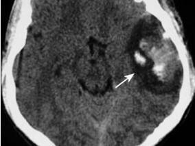 年轻男性,突然出现精神异常,何病?