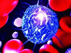 干细胞移植患者营养治疗差异大 这些障碍需清除！