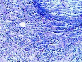 这个和“日剧天王”名字一样的病 您认识吗?