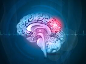 缺乏维生素很可怕 缺血性卒中风险增加