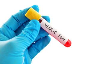 钙+维生素D联合激素疗法可更多降低女性低密度脂蛋白胆固醇