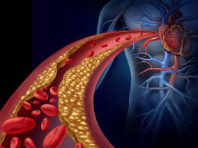 基线HbA1c水平和低血糖与不良心血管事件有多大关联？