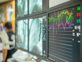 急性心肌梗死:心电图与造影结果不一致怎么办?