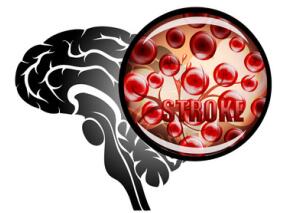 达比加群的早发性出血风险高于华法林？