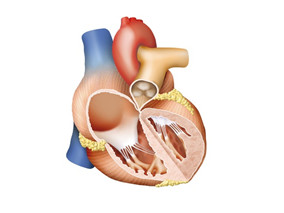 先天性主动脉弓离断 为何中年时才显现症状?