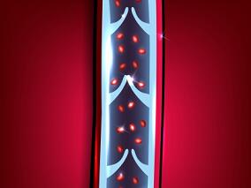 病情反反复复无药可用的成年IgA血管炎患者有了新选择