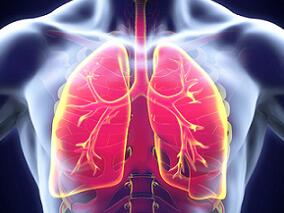 PD-1/PD-L1抑制剂初始治疗NSCLC 糖皮质激素让抗癌神药部分失效