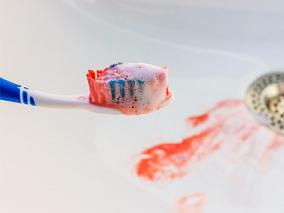 牙龈出血伴鼻出血司空见惯？可能是大麻烦…