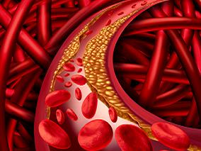 新型直接口服抗凝剂减少治疗中断 噱头还是事实？