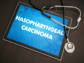 晚期鼻咽癌患者的同步放化疗:基于奈达铂vs顺铂