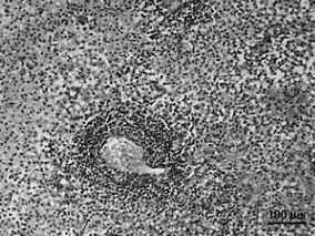 反应迟钝还胡言乱语 原来病在大脑