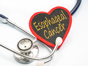 可切除的食管癌：放化疗和手术联合或不联合西妥昔单抗有差吗？